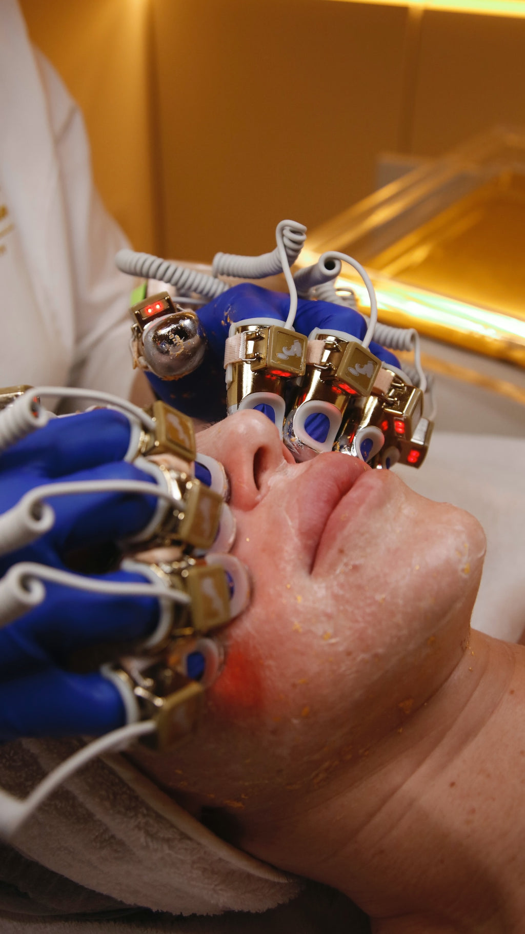 TRATTAMENTO MANUAL LIFT VISO